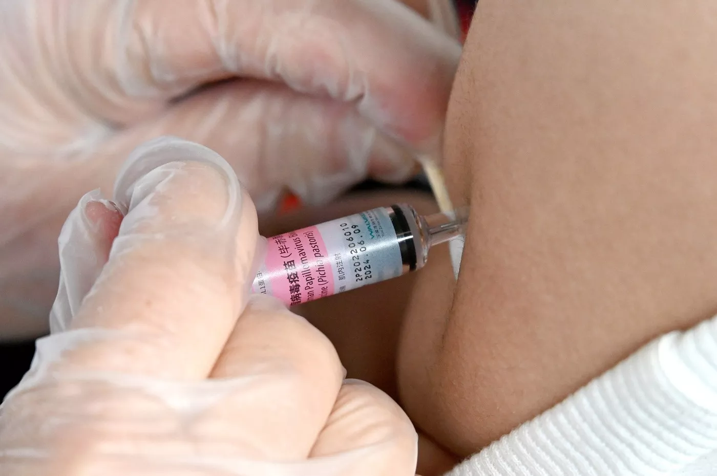 Kina odobrila domaću vakcinu protiv HPV-a