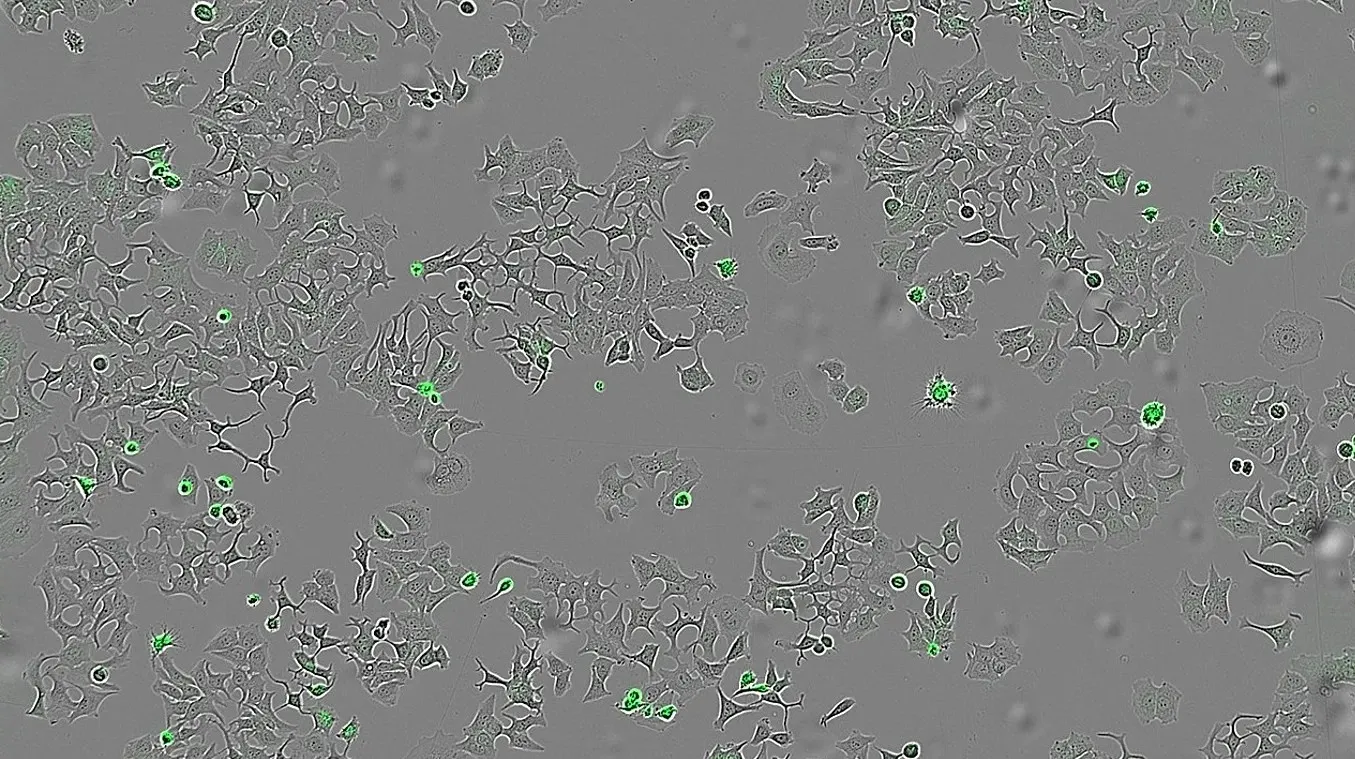 Španski naučnici otkrili protein koji može natjerati ćelije raka na samouništenje