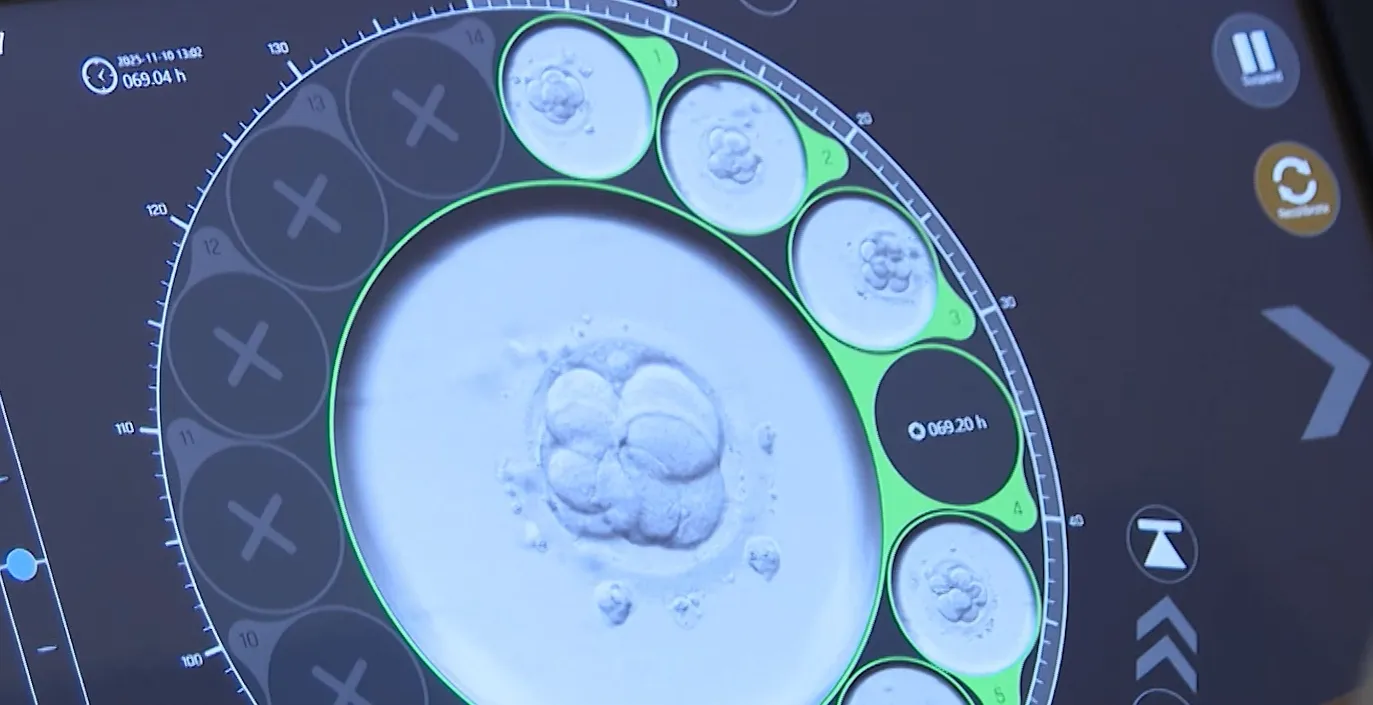 KB Zenica demantovala Ministarstvo zdravstva: Čekamo smjernice za transport i čuvanje embrija